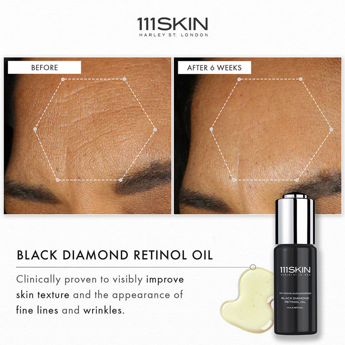 Before and after results of using 111SKIN Black Diamond Retinol Oil