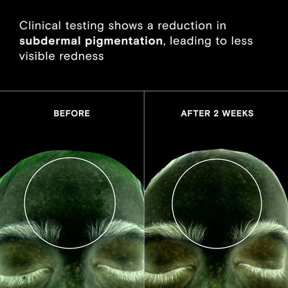 Before and after results of using Exponent Calm Revival Green Tea Resveratrol Power Serum