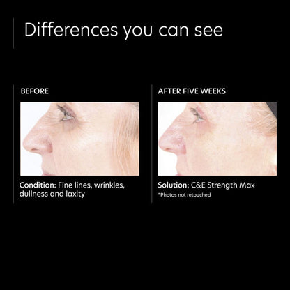 PCA Skin CandE Strength Max