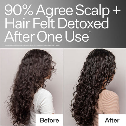 Before and after results of using Act+Acre Clarifying Hard Water Scalp Treatment For Scalp + Hair Build-Up