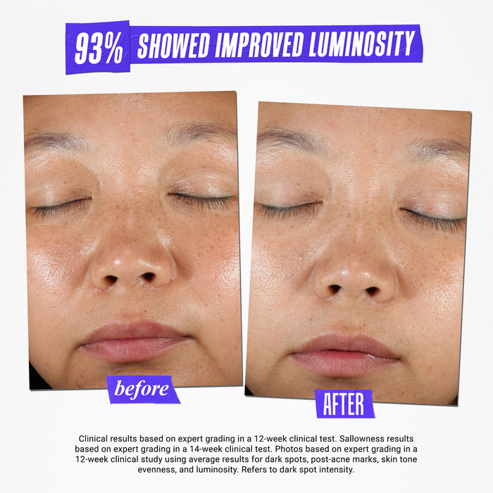 Before and after results of using Kiehl's Since 1851 Clearly Corrective Dark Spot Solution variant: 1 oz