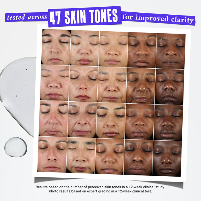 Before and after results of using Kiehl's Since 1851 Clearly Corrective Dark Spot Solution variant: 1 oz