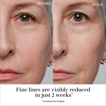 Before and after results of using La Mer Crème de La Mer Face Cream variant: 2 oz