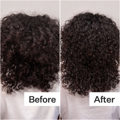 Before and after results of using Act+Acre Daily Hydro Scalp Serum with Hyaluronic Acid for Dry Scalp