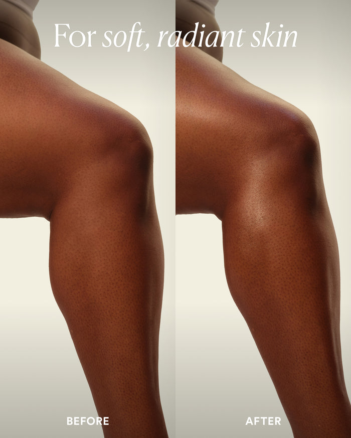 Before-and-after leg comparison highlighting softer, more radiant skin