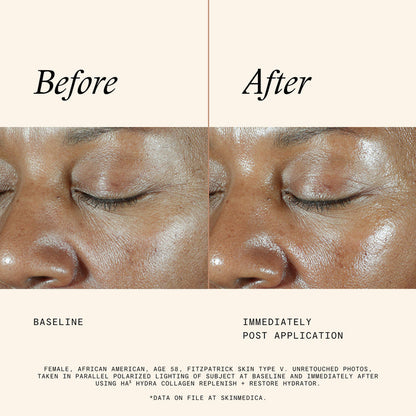 Information related to SkinMedica HA⁵ Hydra Collagen Hydrator with Vegan Collagen