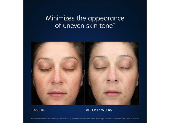 Before and after results of using PCA Skin HydraBright Moisturizer