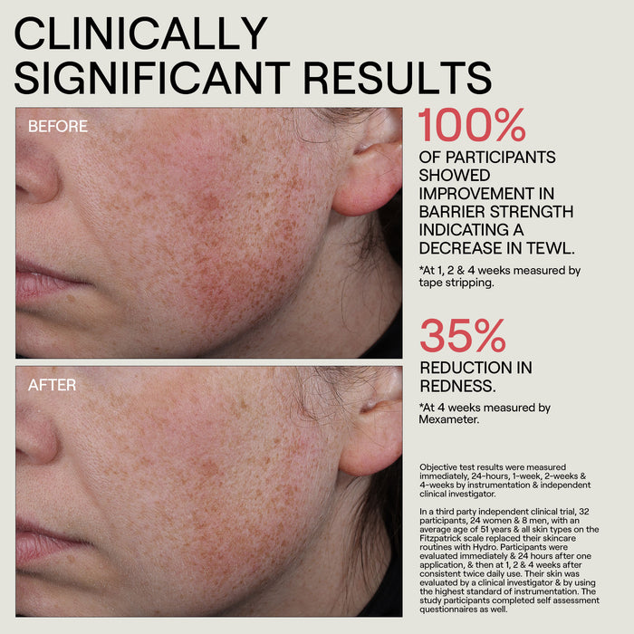 Swatch image of Dr. Diamond’s Metacine HYDR/O Bioactive Hydrolipid Barrier Moisturizer