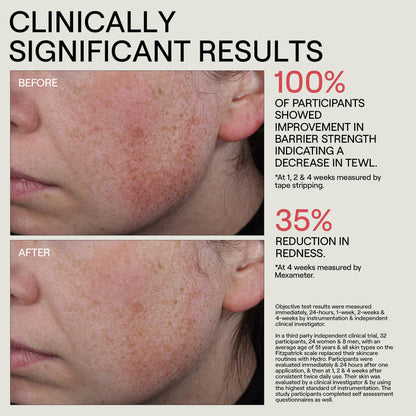 Swatch image of Dr. Diamond’s Metacine HYDR/O Bioactive Hydrolipid Barrier Moisturizer