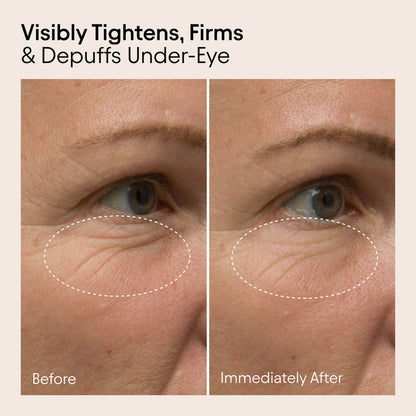 Before and after results of using Alpyn Beauty Line-Filling Eye Cream with Bakuchiol and Caffeine