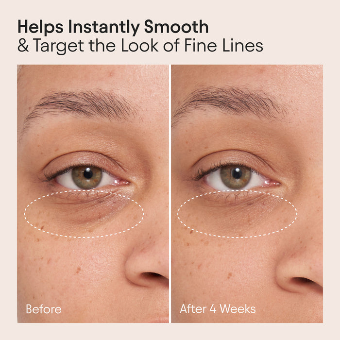 Before and after results of using Alpyn Beauty Line-Filling Eye Cream with Bakuchiol and Caffeine
