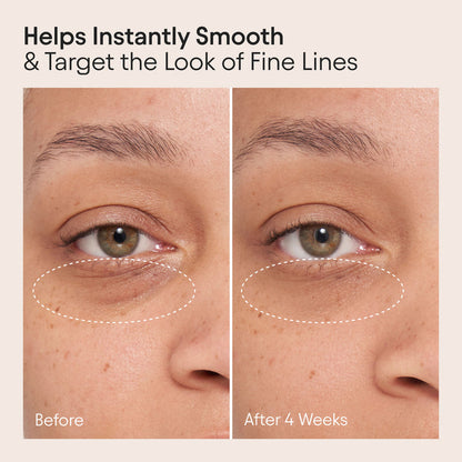 Before and after results of using Alpyn Beauty Line-Filling Eye Cream with Bakuchiol and Caffeine