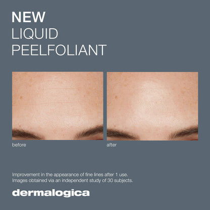 Before and after results of using Dermalogica Liquid Peelfoliant