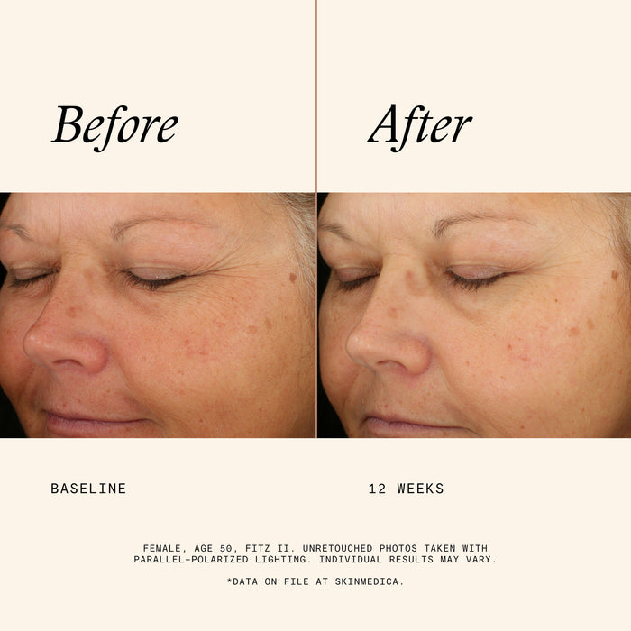 Before and after results of using   variant: 1 fl oz