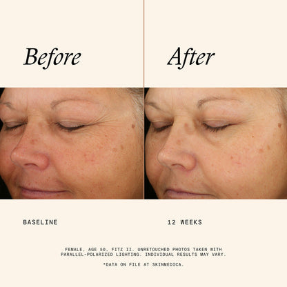 Before and after results of using   variant: 1 fl oz
