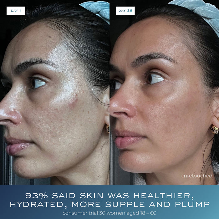 Before and after results of using Element Eight 1.7 fl oz variant: 1.7 fl oz