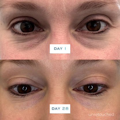Before and after results of using Element Eight O2 Vitamin C Brighten Defend Serum