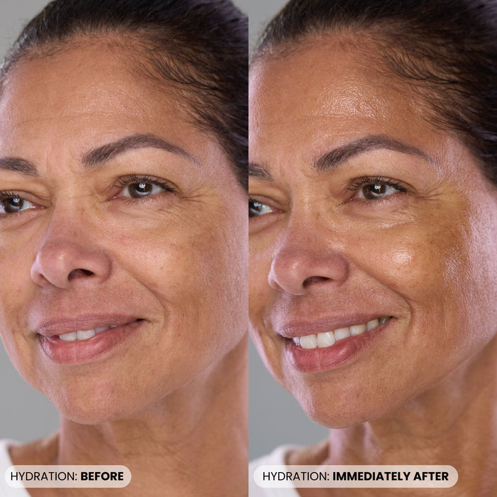 Before and after results of using Dr. Whitney Bowe Beauty P46 Peptide + HA Plumping Serum