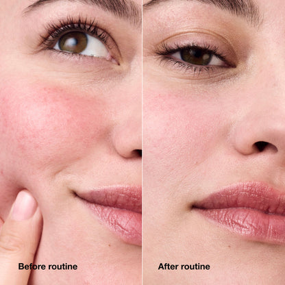 Before and after results of using Clinique Redness Solutions Daily Relief Cream With Probiotic Technology