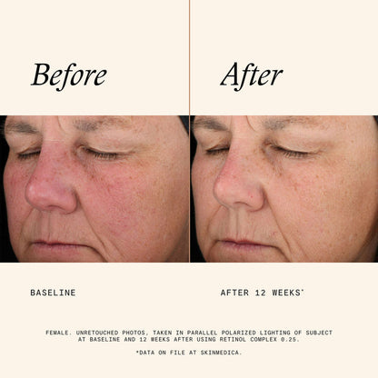 Information related to SkinMedica Retinol Complex 0.25