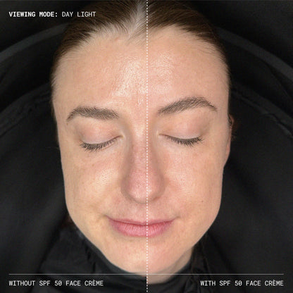 Before and after results of using Emma Lewisham Sunceutical Mineral Face Cream SPF 50