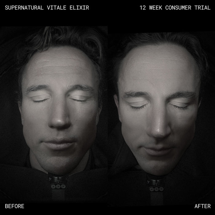 Before and after results of using Emma Lewisham Supernatural Vitale Face Elixir