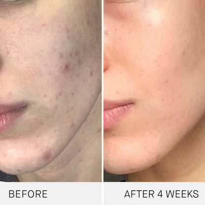 Before and after results of using Augustinus Bader The Cream variant: 1.0 fl oz