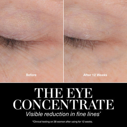 Before and after results of using La Mer The Eye Concentrate