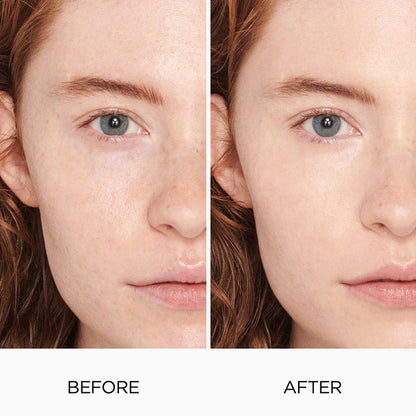 Before and after results of using   variant: 0N1 PETAL