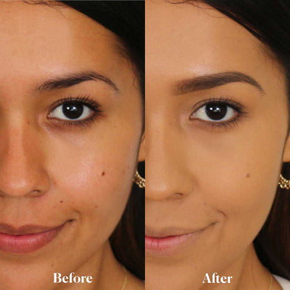Before and after results of using Laura Mercier Translucent Loose Setting Powder variant: Honey